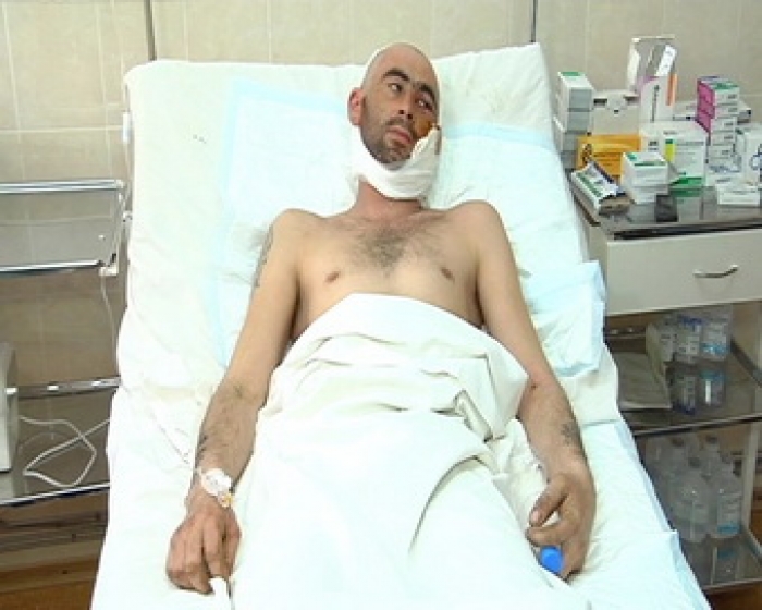 Військовий Микола Федоришин із Закарпаття після кількагодинної операції уже заговорив