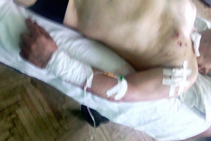 В сусідній з Закарпаттям області намагалися підірвати держпосадовця
