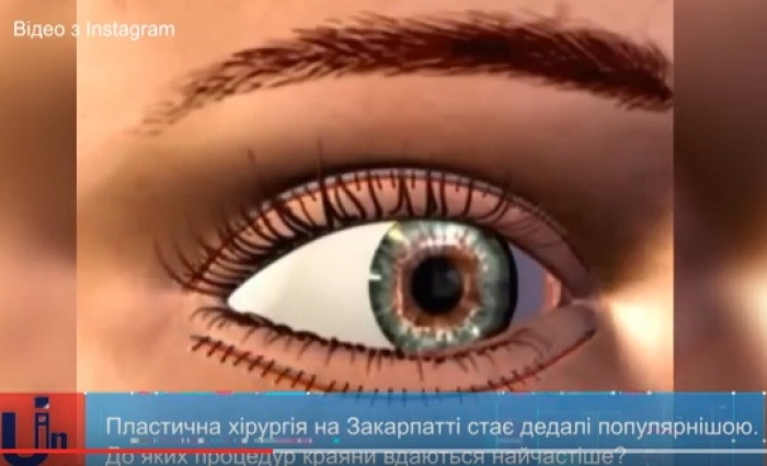 Чим найчастіше займаються закарпатські пластичні хірурги