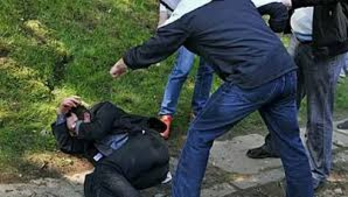 Поліцейські Ужгорода затримали неповнолітнього, який побив чоловіка