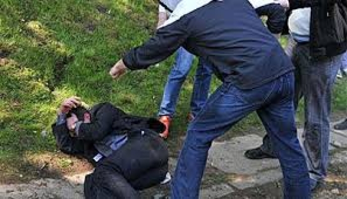 Через бійку в жителя столиці Закарпаття — тілесні ушкодження середньої тяжкості