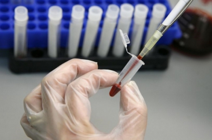 Коли стає заразним хворий на гострий вірусний гепатит А?