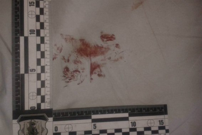 22-річна закарпатка "бійні" не стерпіла і нанесла чоловіку один удар в живіт — ножем