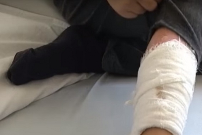 Ужгородка катувала 9-річного всиновленого нею хлопчика, – справу вирішує поліція