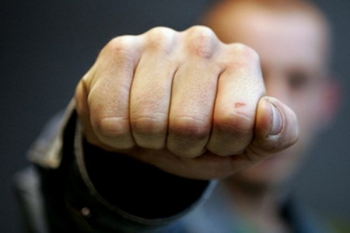 Закарпатець зазнав смертельного удару по голові...