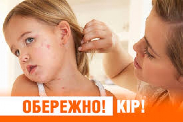 Очільник Закарпаття: "Майже 90 відсотків з усіх хворих на кір – це діти до 17 років..."