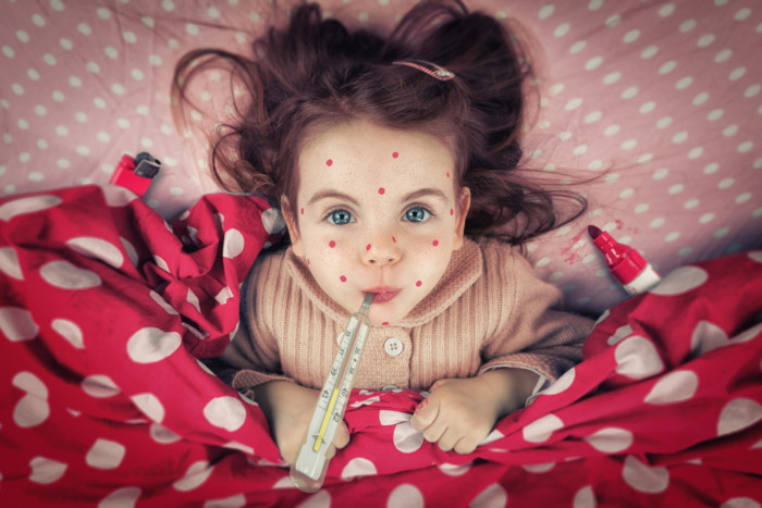 Закарпаття – в трійці областей України з найбільшим захворюванням на кір