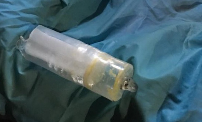 Закарпатська прокуратура оголосила про підозру "зубному доктору", який продавав психотропи