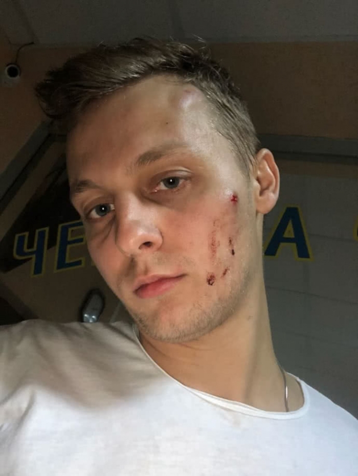 "Ряжені" під полісменів нападники побили сина нардепа-закарпатця