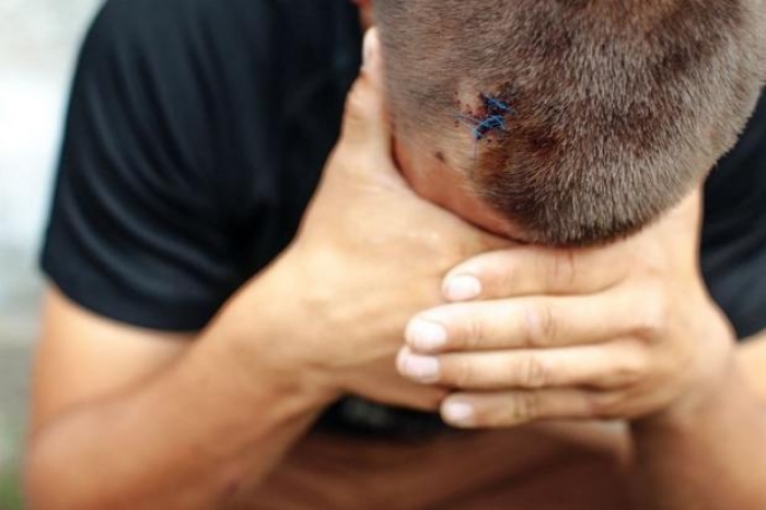 На Мукачівщині копи затримали місцевого, який відлупцював односельчан