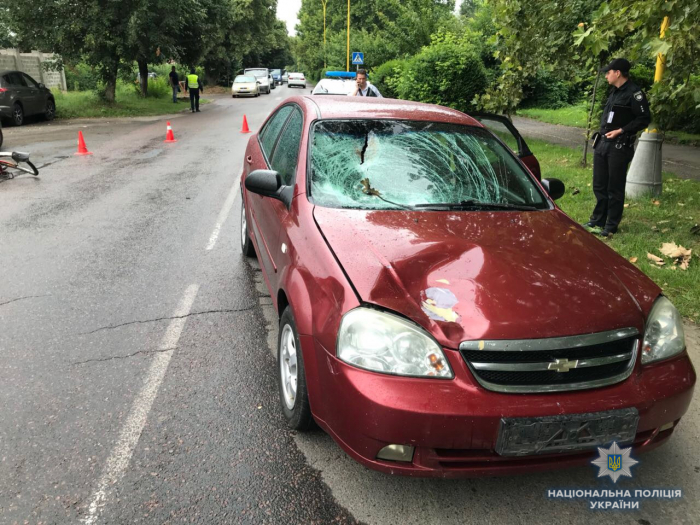 Ужгородський пенсіонер після "зустрічі" з іномаркою опинився у лікарняній палаті 