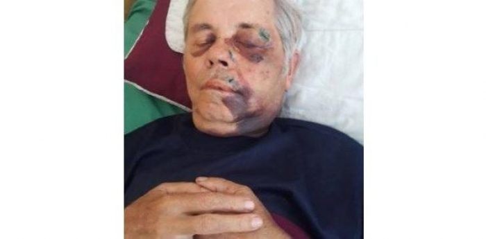 У Чорнотисові невідомі жорстоко обійшлися зі священиком Свято-Вознесенського храму