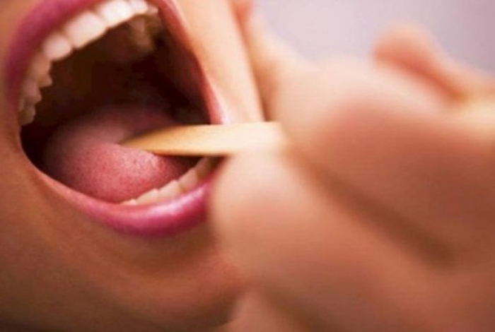 В Ужгороді зафіксовано ще два випадки дифтерії?