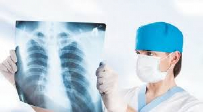 Відтепер на Закарпатті діють сучасні діагностичні системи для виявлення туберкульозу (ВІДЕО)