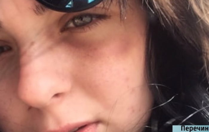 Дівчина з Перечина боїться вийти із дому після того, як її побили