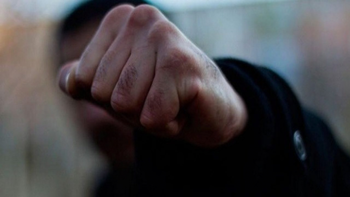 На Мукачівщині двоє чоловіків відлупцювали поліцейських – у потерпілого струс мозку