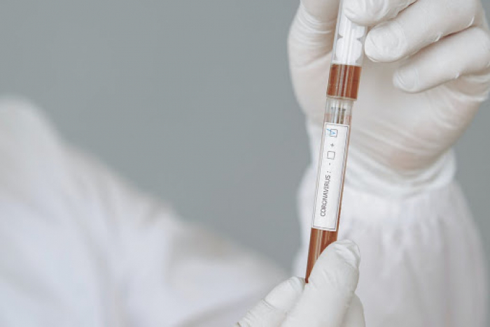 За добу ще 26 ужгородців "підчепили" коронавірусну інфекцію