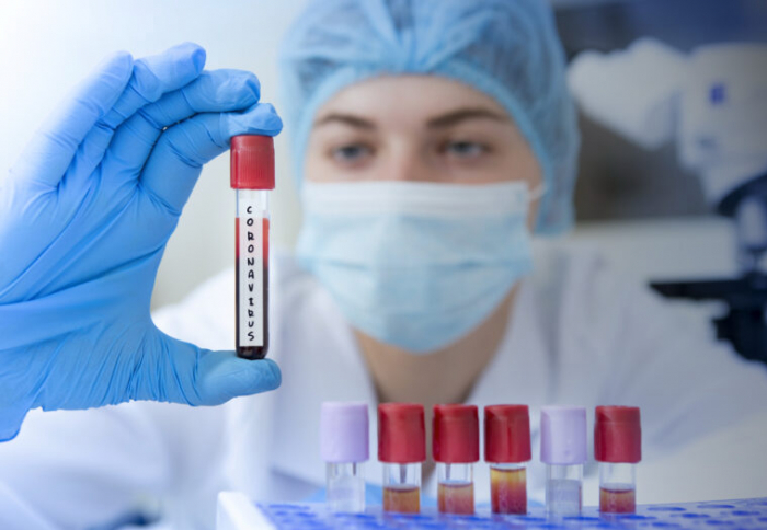 Стало відомо, скільки ужгородців "підчепили" COVID-19 за добу