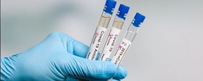 Закарпаття: за добу, що минула, померло п'ятеро хворих із діагнозом COVID-19