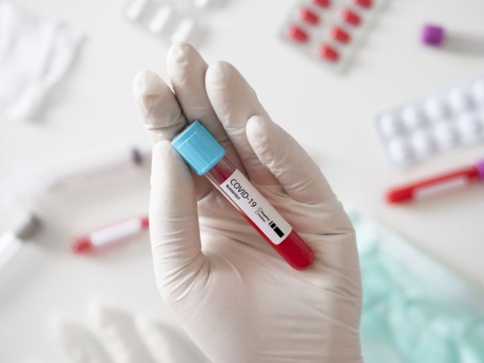 В Ужгороді за добу виявлено 57 нових випадків коронавірусу, 3 людей померло