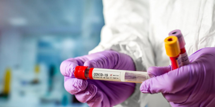 За добу в Ужгороді виявлено 18 нових випадків коронавірусної інфекції