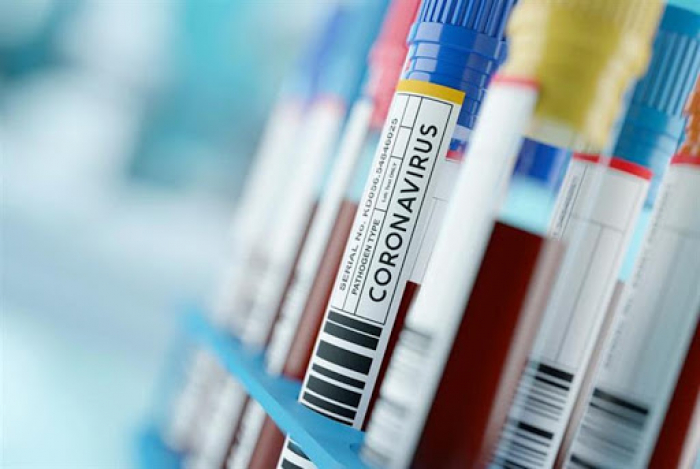 Закарпаття і коронавірус: 414 випадків за добу та 12 пацієнтів померло (ІНФОГРАФІКА)