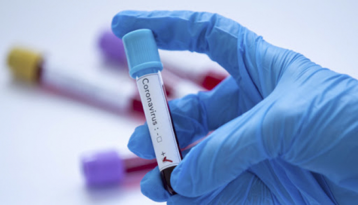 Стало відомо, скільки нових випадків коронавірусної інфекції виявлено в Ужгороді