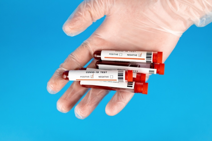 COVID-19: за минулу добу на Закарпатті зафіксовано 148 нових випадків, дві людини померли