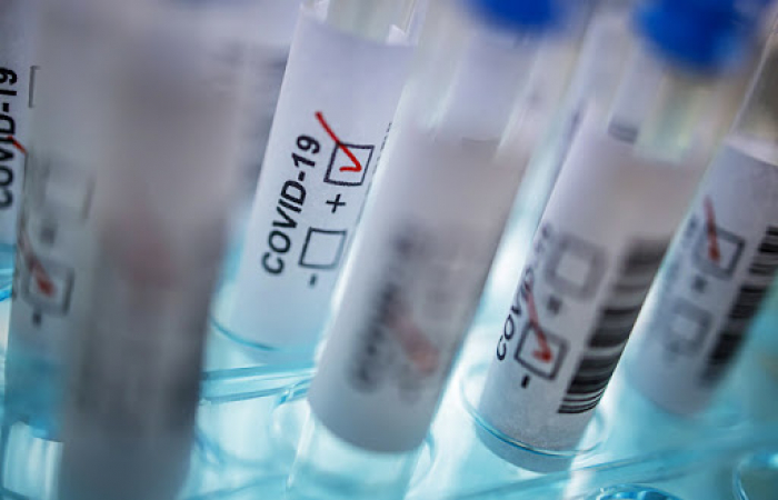 COVID-19 на Закарпатті: про інфікування дізнались ще 315 закарпатців за добу