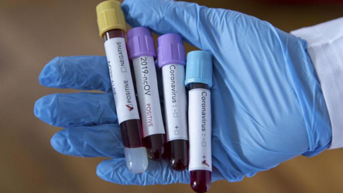 Ситуація із коронавірусом в Ужгороді: COVID-19 підтверджено у 72 пацієнтів