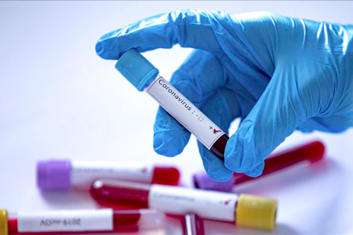 Восьма жертва на Закарпатті від COVID-19 – мешканець Виноградівщини