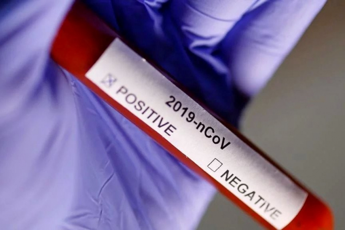 Коронавірус в Закарпатті: кількість інфікованих перевищила 400 осіб