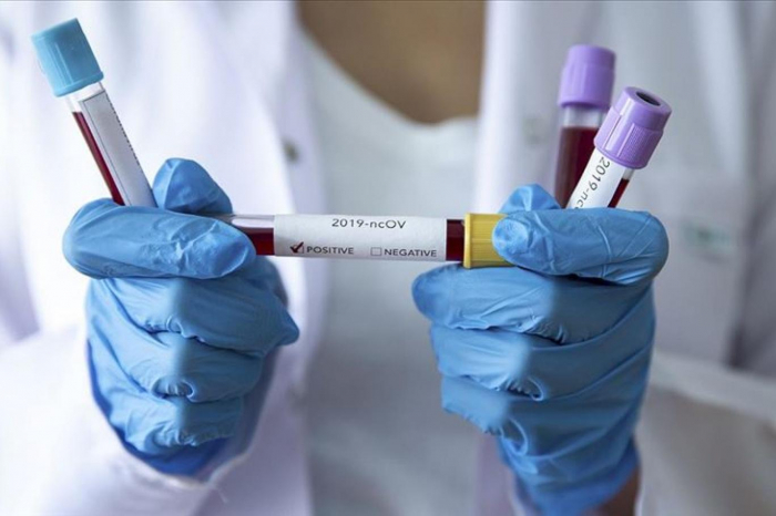 На Закарпатті – 110 випадків захворювання на COVID-19