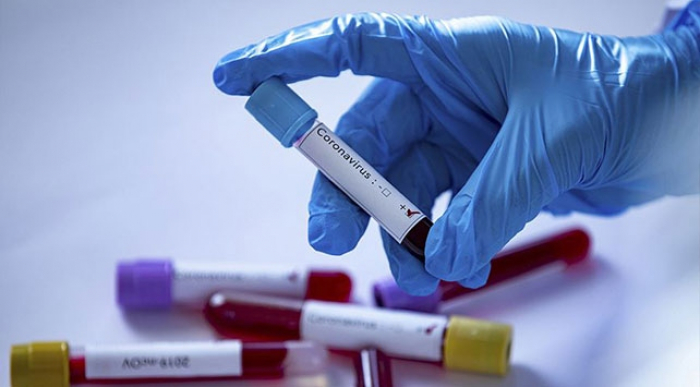 МОЗ підрахував, скільки усього українців можуть заразитися коронавірусом