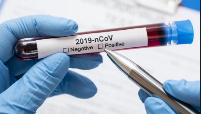 У 146 ужгородців лабораторно підтверджено COVID-19