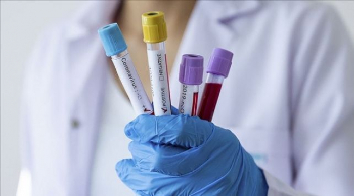 На Закарпатті – 375 пацієнтів з підтвердженим COVID-19