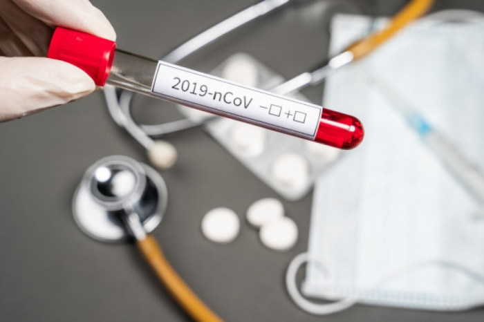 Плюс 9 нових випадків – у 352 ужгородців підтверджено коронавірус