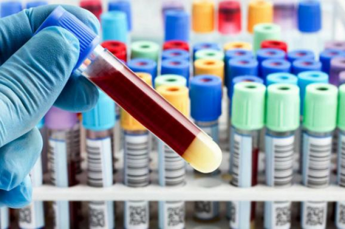 11 нових випадків коронавірусної інфекції виявлено за минулу добу в Ужгороді