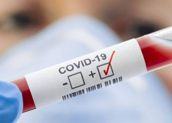 Отакої: за минулу добу у 109 закарпатців підтверджено коронавірус методом ПЛР!