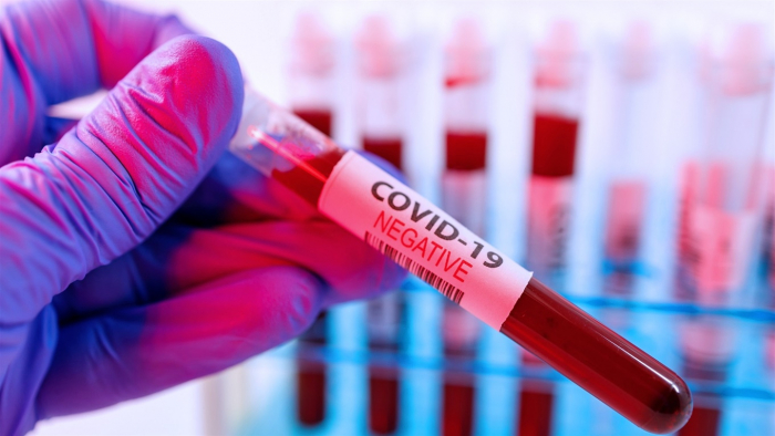 Перемога близько! Нових випадків коронавірусної інфекції за минулу добу в Ужгороді не виявлено!