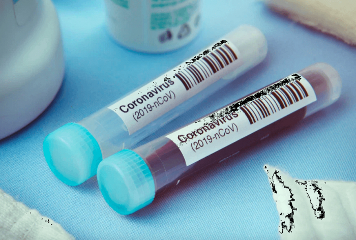 За минулу добу в 35 закарпатців підтверджено коронавірус