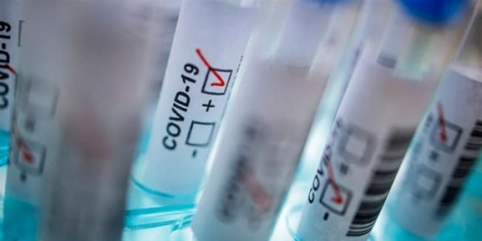 З початку епідемії 570 ужгородців захворіли на коронавірус