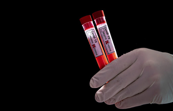 Закарпаття і COVID-19: 75 нових випадків за добу, четверо пацієнтів померло