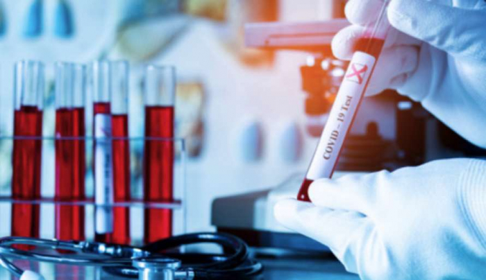 COVID-19 на Закарпатті: за добу 4 смерті і 72 випадки інфікування