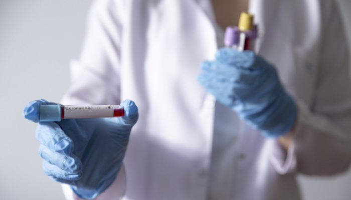 В Ужгороді за добу виявлено 8 нових випадків коронавірусної інфекції