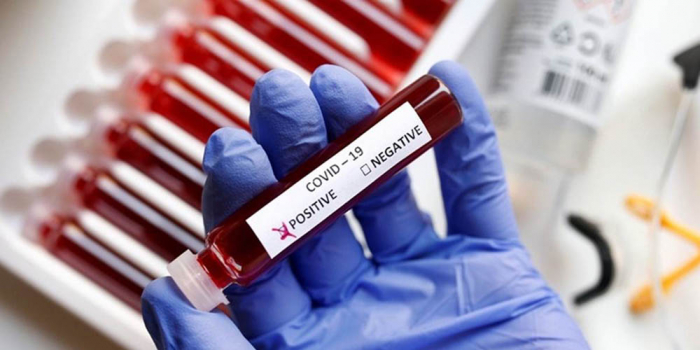 COVID-19 на Закарпатті: 67 нових випадків за добу, один пацієнт помер