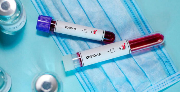 Доба на Закарпатті: у 37 осіб підтверджено коронавірус методом ПЛР