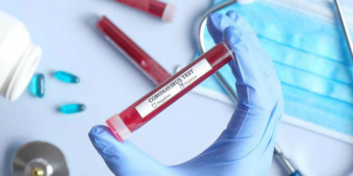 COVID-19 на Закарпатті: 51 випадок за добу та одна людина померла