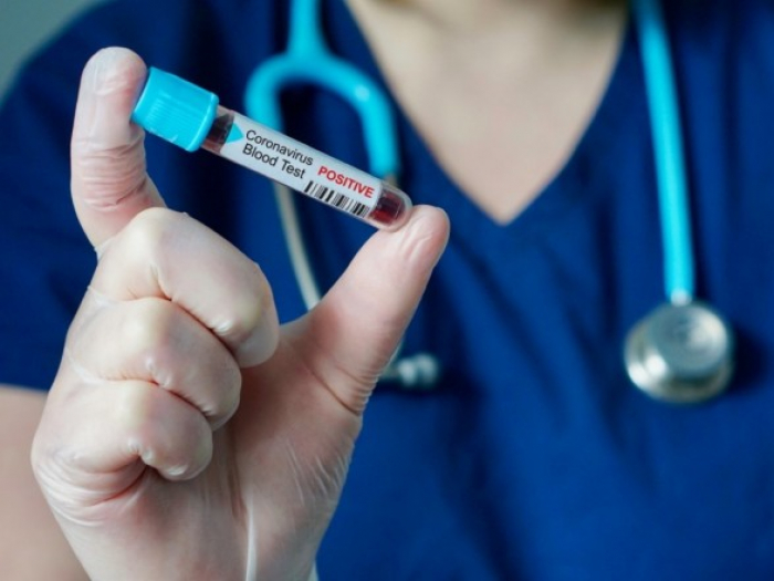 Ситуація з COVID-19 в Закарпатті: 66 нових випадків коронавірусу за добу, 4 людини померли