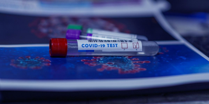 За добу в Ужгороді виявлено 9  нових випадків коронавірусної інфекції